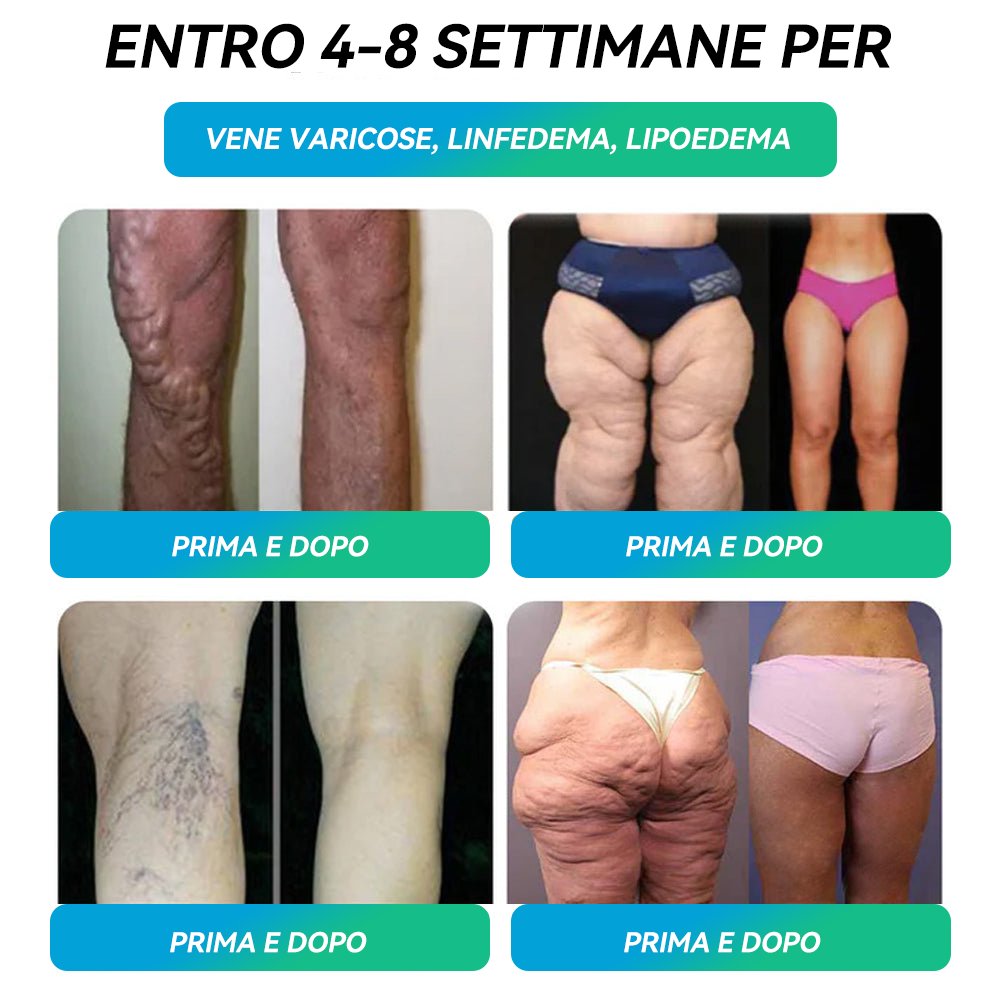 Ourlyard® 🔥 GLP-1 Sei-in-Uno Soluzione Orale per la Salute (Solo una volta al giorno, cambiamenti visibili in 7 giorni) 👩⚕️ Per obesità, salute cardiovascolare, diabete, apnea notturna, salute intestinale, problemi articolari e molto altro ancora